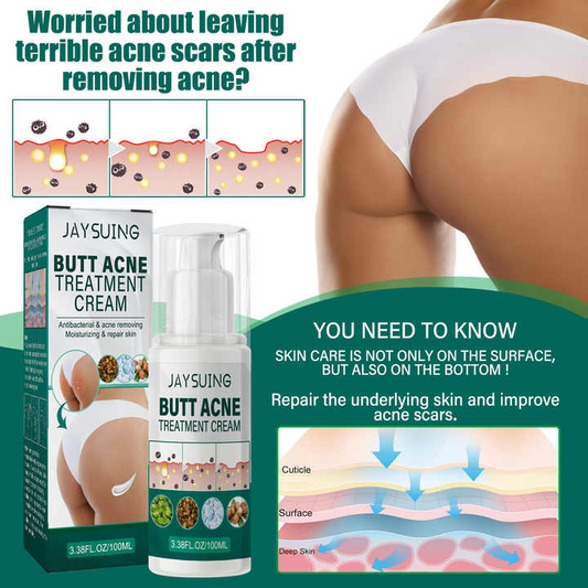 Crème anti-acné à base de plantes biologiques de marque privée, réparatrice des fesses, rougeurs, rétrécissement des pores, meilleur traitement des boutons